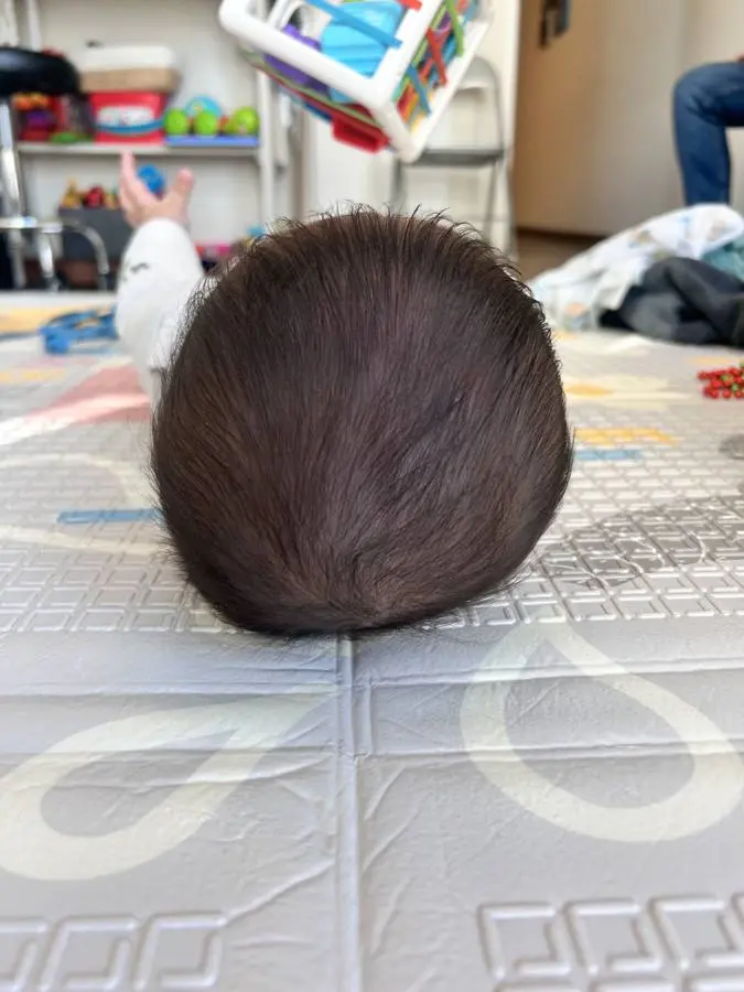 ¿Por qué le pasa esto a mi bebé?