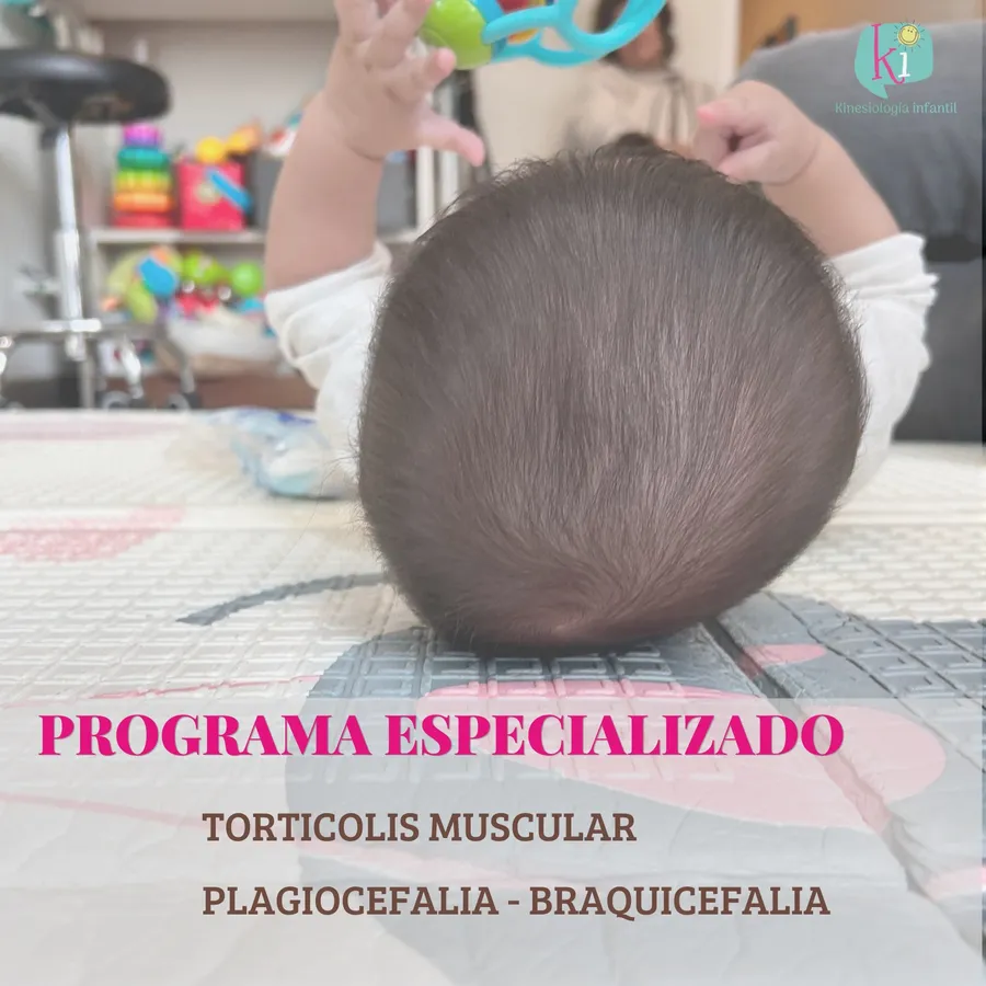 Bebé boca abajo en una sesión del programa de plagiocefalia y tortícolis